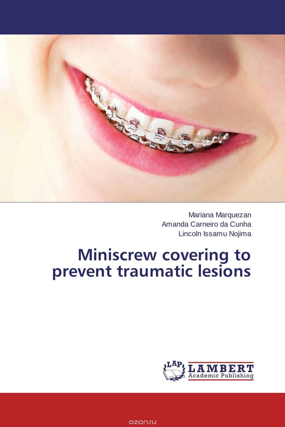 Скачать книгу "Miniscrew covering to prevent traumatic lesions"