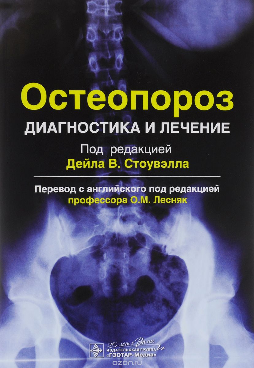 Скачать книгу "Остеопороз. Диагностика и лечение"
