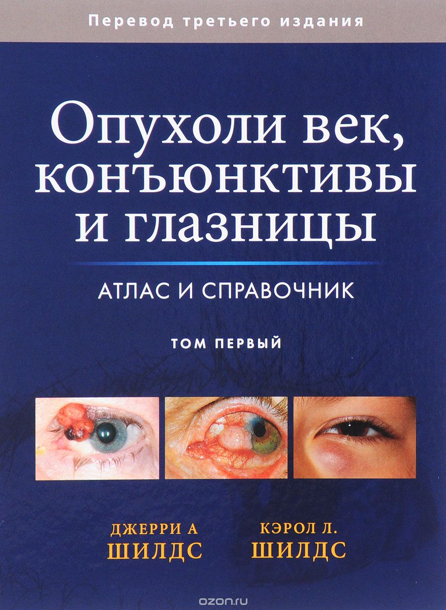 Скачать книгу "Опухоли век, конъюнктивы и глазницы. Атлас и справочник. В 2 томах. Том 1, Джерри А. Шилдс, Кэрол Л. Шилдс"