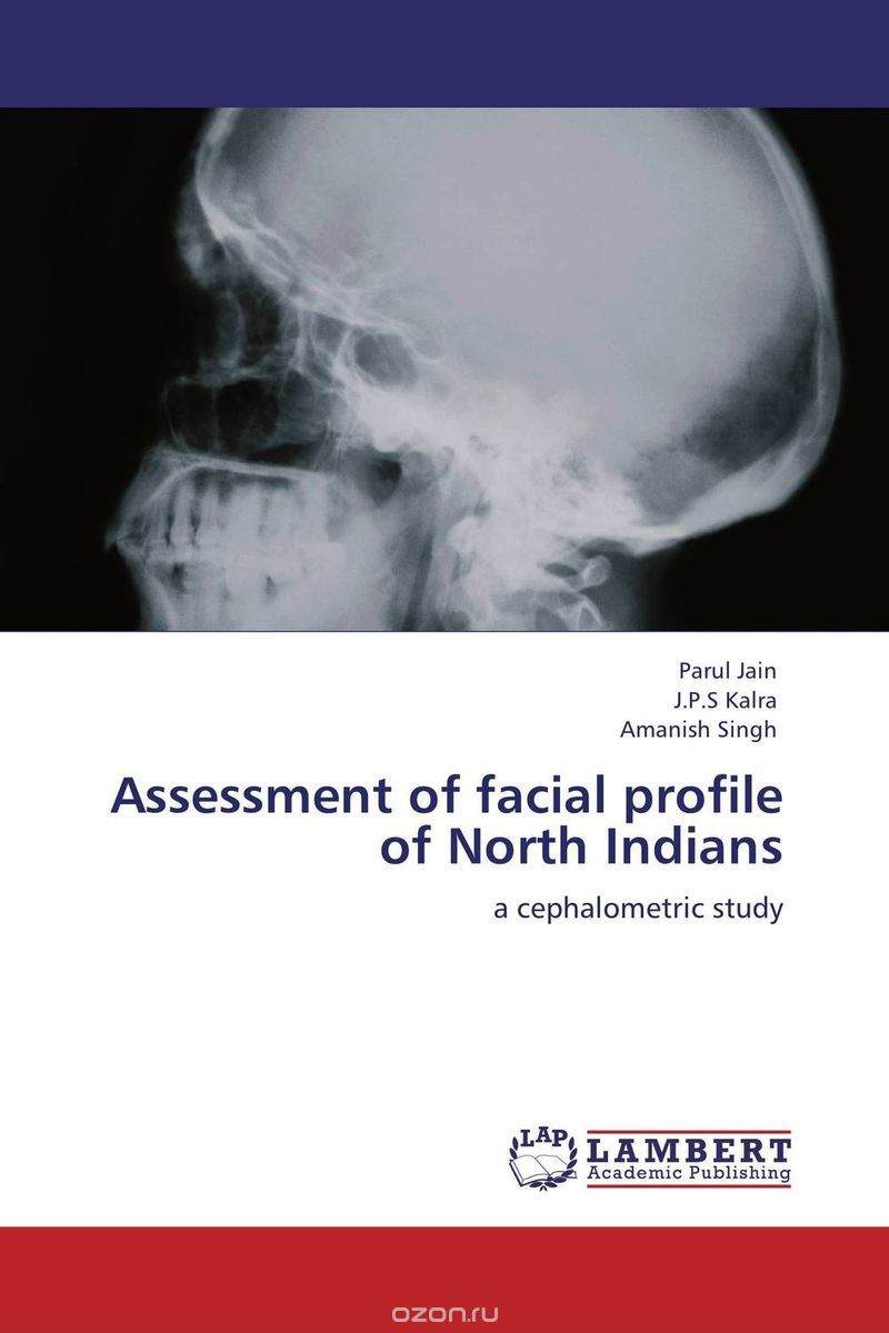 Скачать книгу "Assessment of facial profile of North Indians"