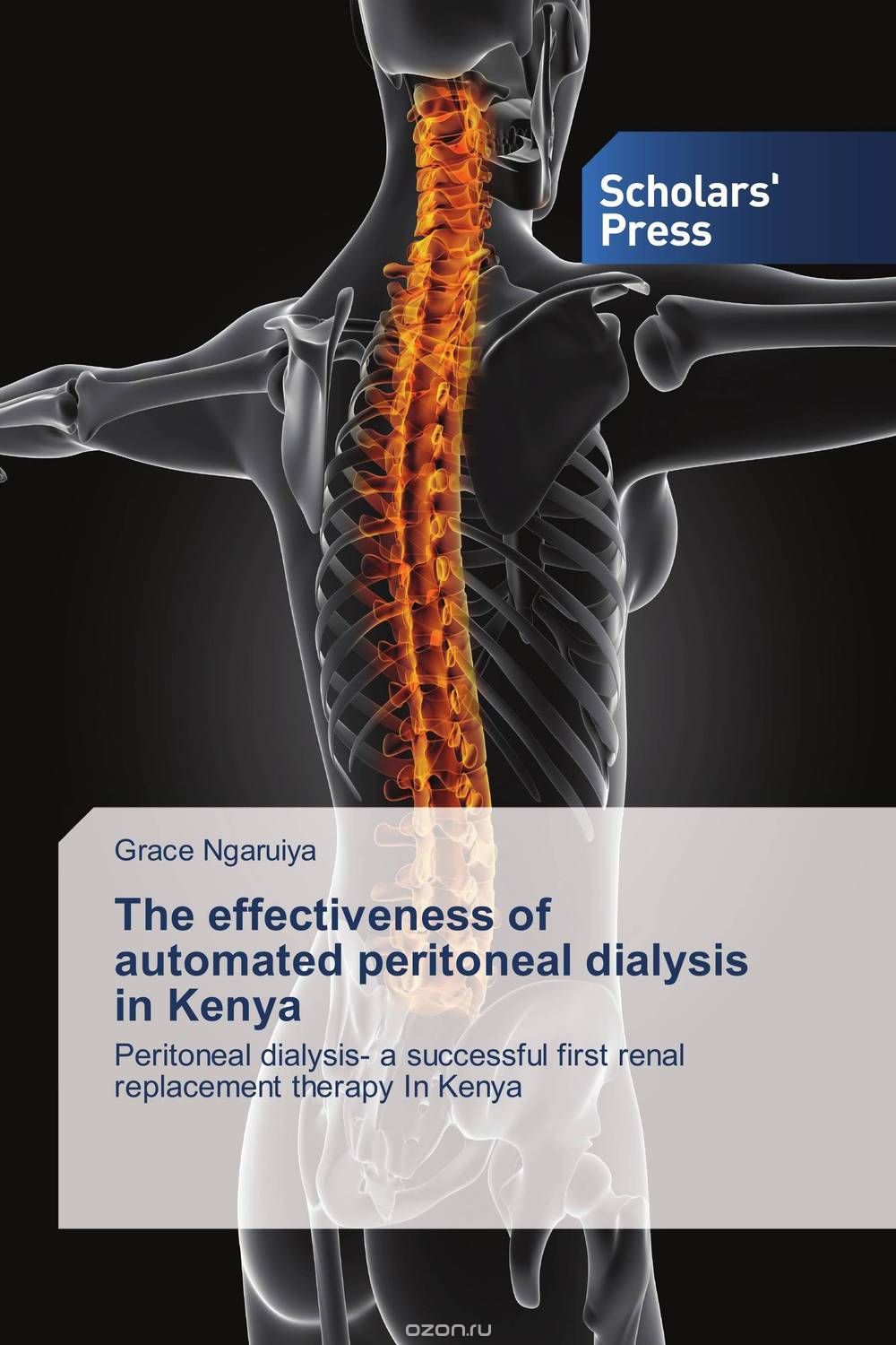 Скачать книгу "The effectiveness of automated peritoneal dialysis in Kenya"